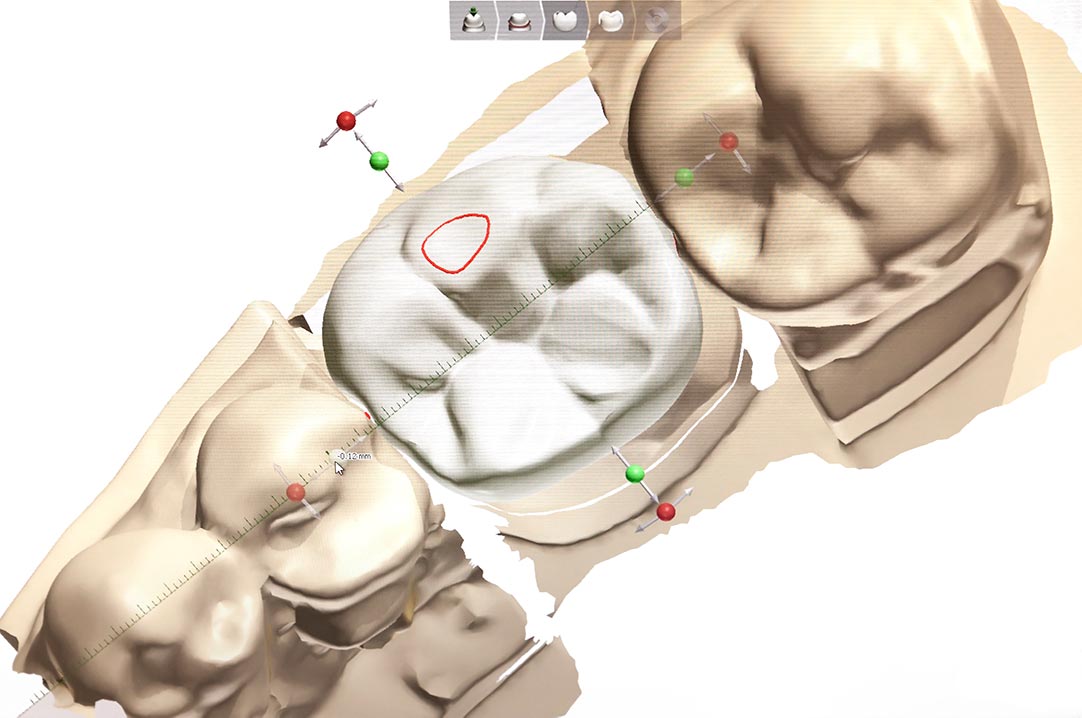 Cadcam Cadcam
