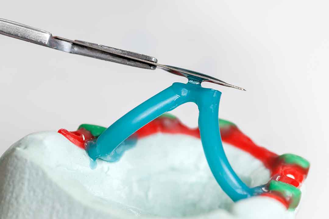 Modellguss Zahntechnik Modellguss